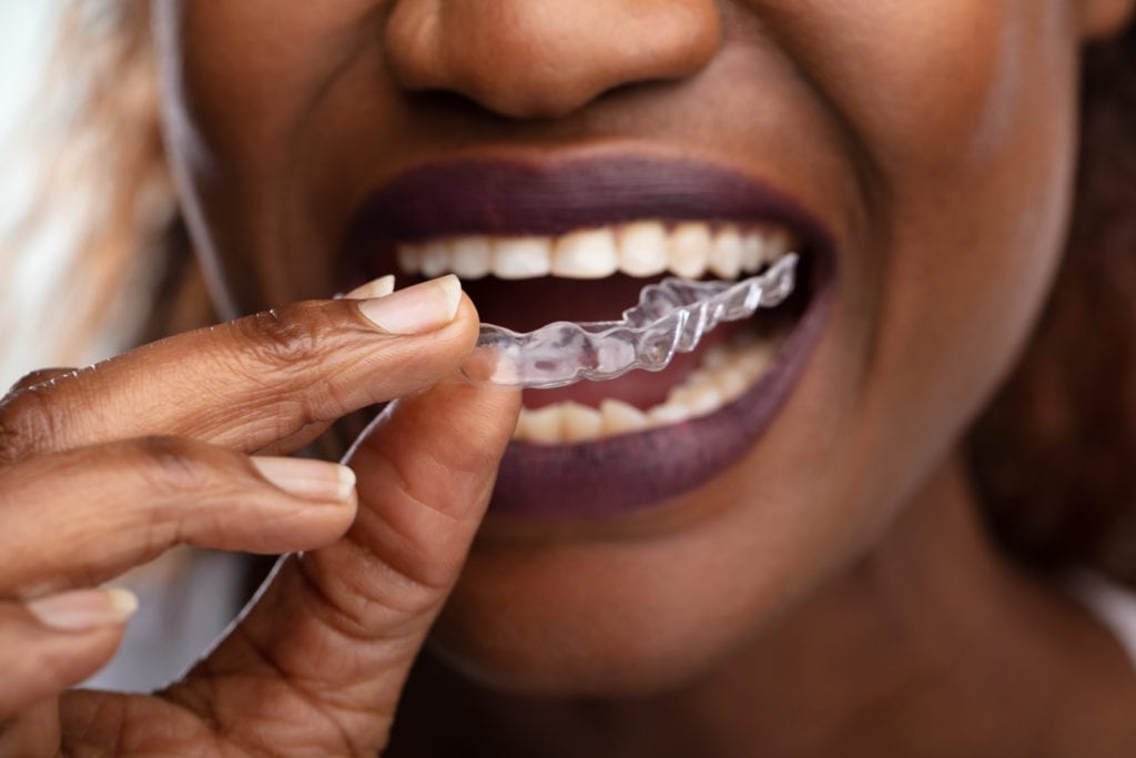 Clear Braces in Jackson Heights and East Elmhurst