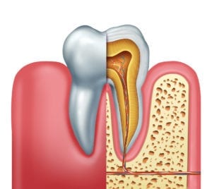 root canal treatment in jackson heights ny