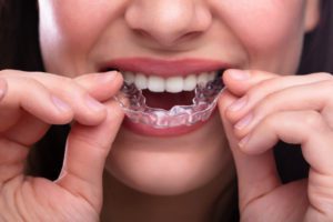 Invisalign Provider in Jackson Heights NY