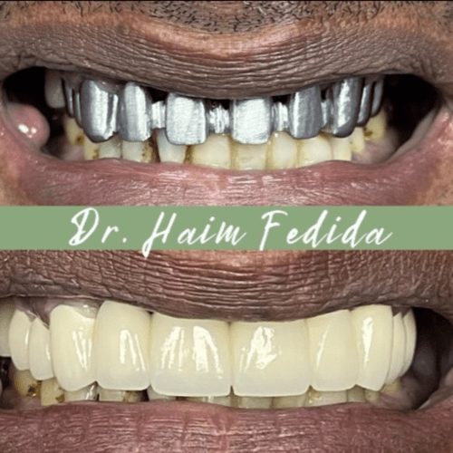 After dentistry at Fedida Family Dentistry & Dental Spa