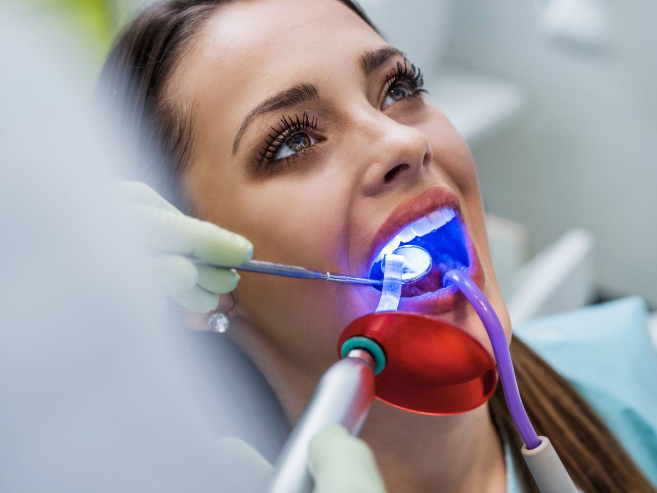 Young woman receiving dental examination with medical laser. laser dentistry dentist in Jackson Heights New York