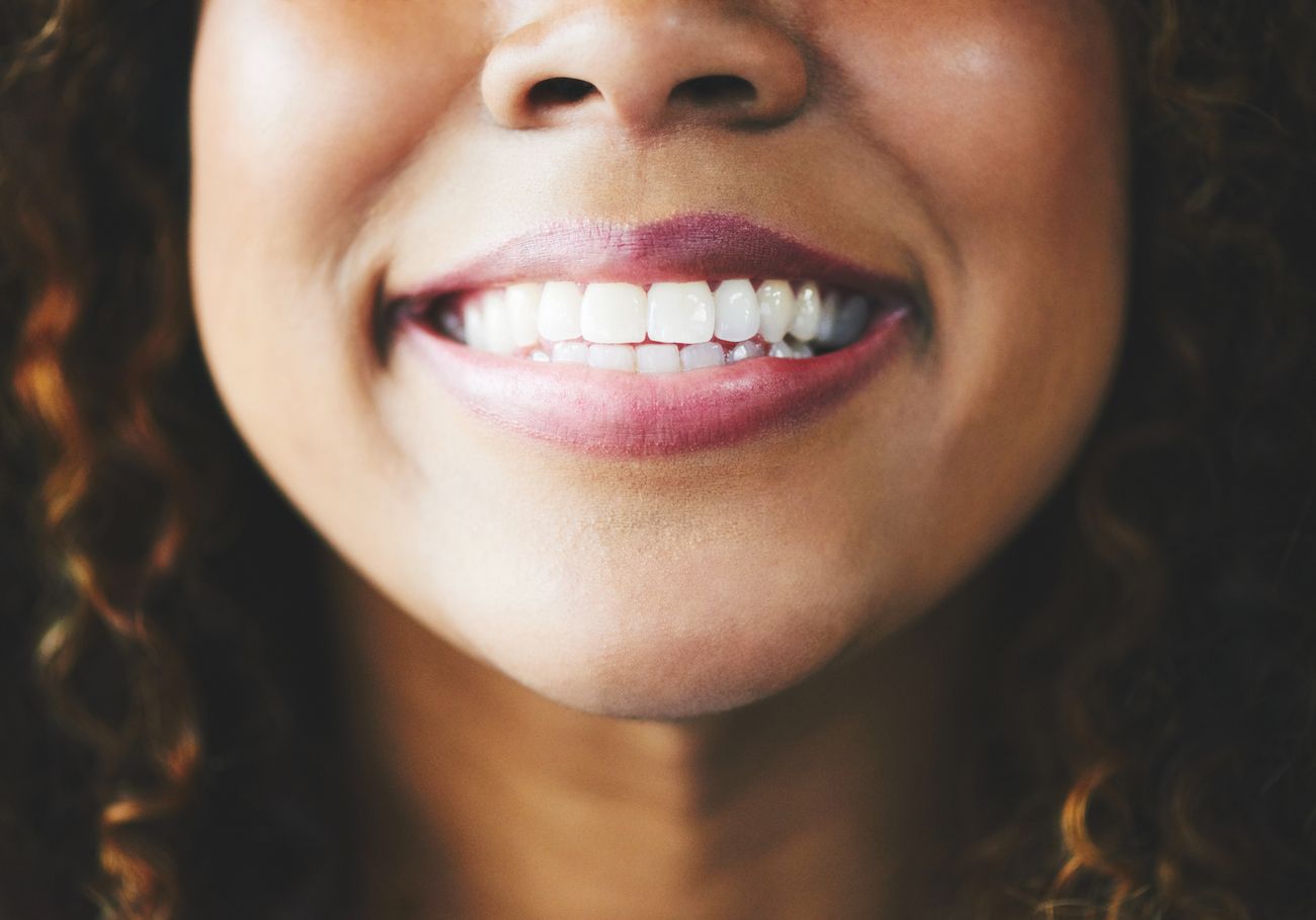 Zoomed and cropped image of woman with pretty, perfect smile tooth bonding cosmetic dentistry dentist in Jackson Heights New York