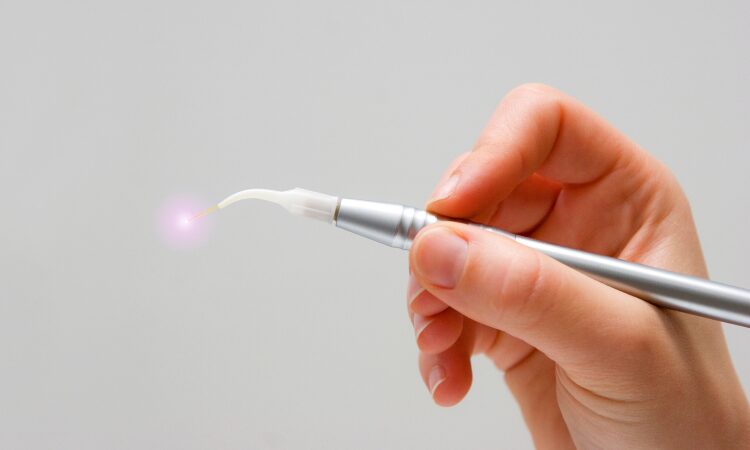 Laser dentistry represents a significant advancement in dental care. It offers precise treatments with minimal discomfort.